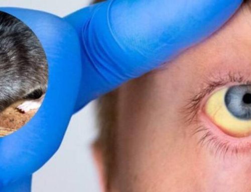 Detectan un caso de leptospirosis en un barrio privado de Ingeniero Maschwitz